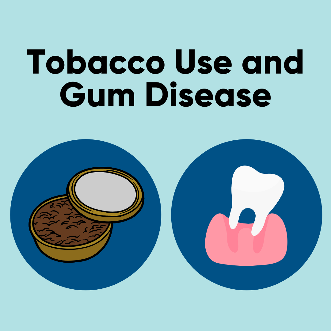 The text, 'Tobacco use and gum disease' above clip art of a tin of chewing tobacco and a tooth lifting out of its socket.