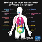 Cancer and Smoking_CDC.png