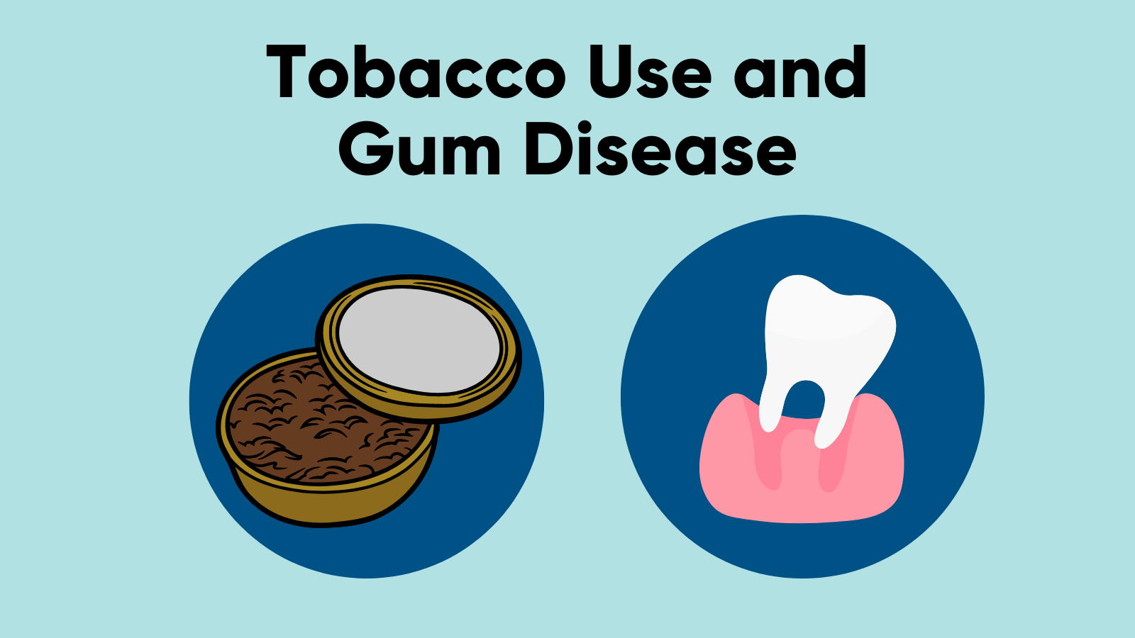 The text, 'Tobacco use and gum disease' above clip art of a tin of chewing tobacco and a tooth lifting out of its socket.